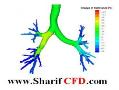 انجام پروژه مهندسی پزشکی  فلوئنت fluent  - تهران