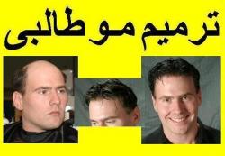 ترمیم مو و کاشت مو در خانم ها و اقایان  - تهران