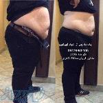 دستگاه لاغری 