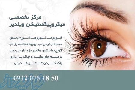 میکروپیگمنتیشن ویلدیر 