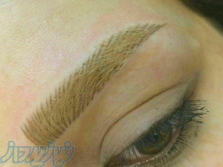 ميكروپيگمنتيشن