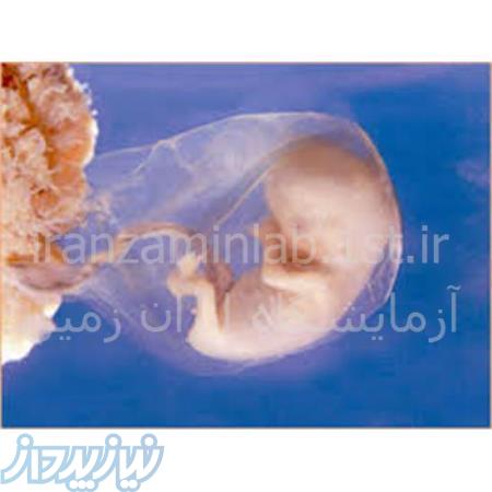 آزمایش غربالگری جنین 