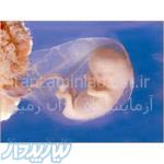 آزمایش غربالگری جنین 