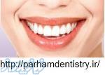 لامینت دندان های خود را زیبا کنید 