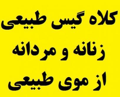 فروش کلاه گیس زنانه و کلاه گیس مردانه با موی طبیعی  - تهران