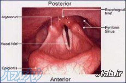 کلینیک صوت حرفه ای و بیماریهای عملکردی حنجره دکتر صالحی 