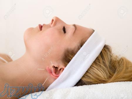 کلینیک طب سوزنی و زیبایی خانم دکتر الهام بهمنش