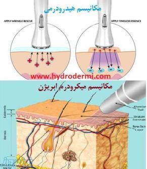 پاکسازی عمیق پوست با دستگاه میکرودرم و و آبرسانی با دستگاه هیدرومی 