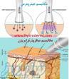 پاکسازی عمیق پوست با دستگاه میکرودرم و و آبرسانی با دستگاه هیدرومی 