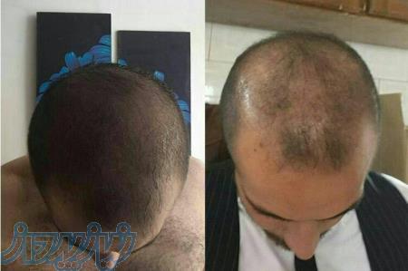 محلول تقویت کننده رشد مو  و ابرو 