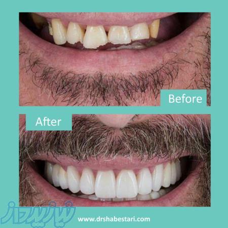 دندانپزشکی زیبایی در مشهد 