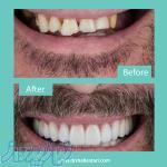 دندانپزشکی زیبایی در مشهد 