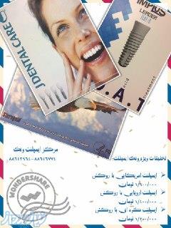 کاشت دندان ( ایمپلنت ) با مناسب ترین قیمت 