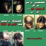 کلینیک تخصصی ترمیم مو گلهای تهران