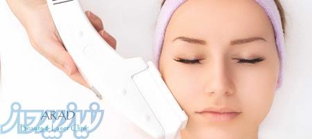 لیزر موهای زائد