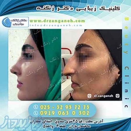 دکتر زنگنه متخصص جراحی بینی 