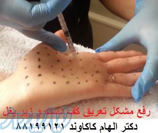 بوتاکس خوب و ارزان 