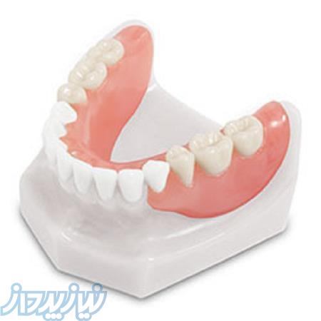 دندان مصنوعی