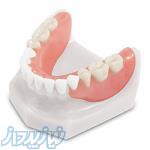 دندان مصنوعی