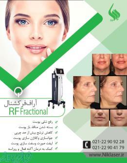 دستگاه آر اف فرکشنال سوزنی RF Secret