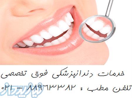 بهترین دندانپزشکی مرکز تهران عصب کشی دندان 