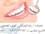 بهترین دندانپزشکی مرکز تهران عصب کشی دندان 