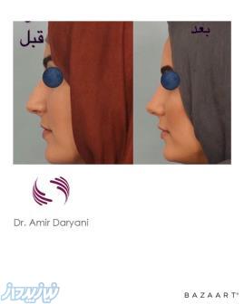 بهترین جراح لیپوماتیک پیکر تراشی فوق تخصص جراحی پلاستیکiran plastic surgery best