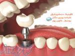 بهترين دندانپزشکي در منطقه سعادت آباد 