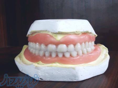 ساخت انواع دندان مصنوعی