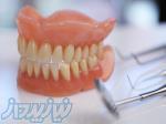 دندانساز ماهر ( تكنسين دندانسازي ) استخدام دندانساز