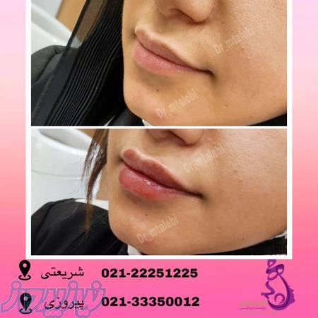 پزشک پوست ومووزیبایی