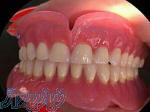 دندانسازي با بيمه